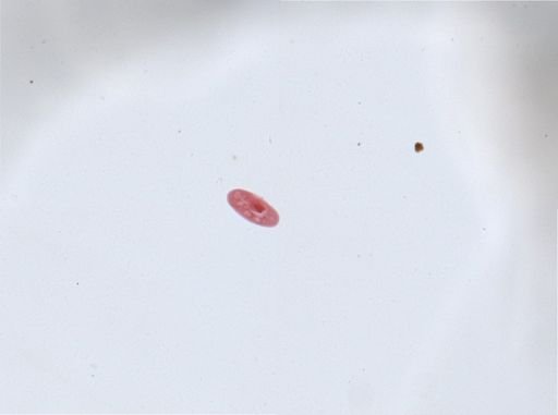 Paramecium aurelia