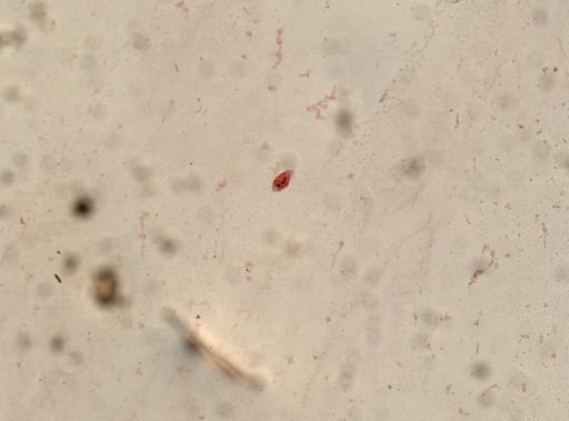 Oxytricha
