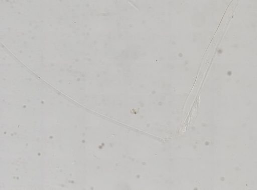 Paramecium
