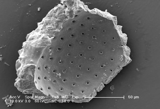 Globigerinoides ruber
