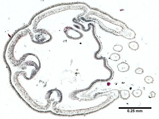 Scyphozoa