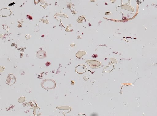Distomum