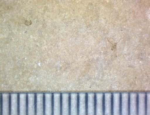 undet. Hexapoda
