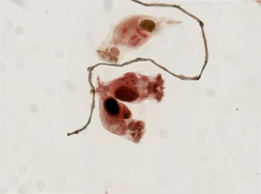 Epiphanes senta