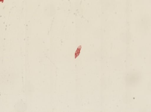 Spirostomum ambiguum