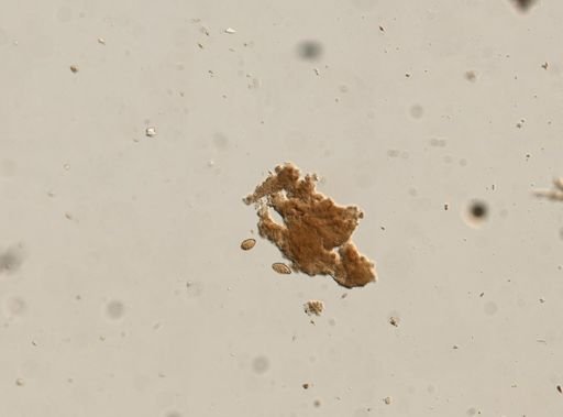Diphyllobothrium canis