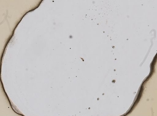 Cephalodella intuta