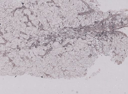 Modiolus