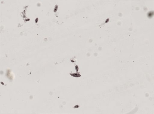 Oxytricha