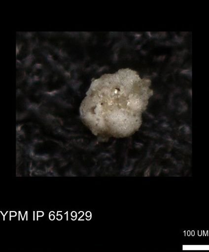 undet. Rugoglobigerinidae