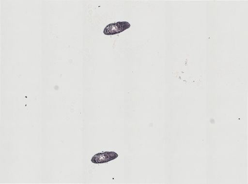 Plagiostomum stellatum