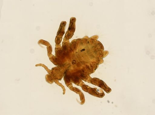 Pthirus pubis