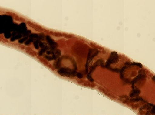 Haematoloechus parviplexus