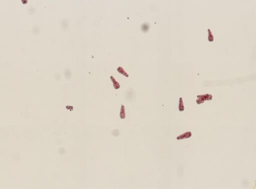 Fasciola hepatica