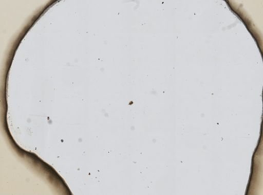 Lepadella imbricata