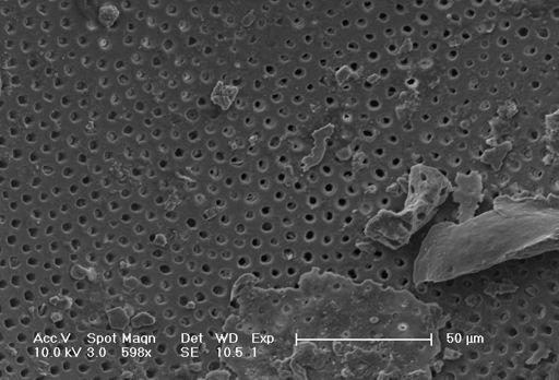 Globorotalia menardii