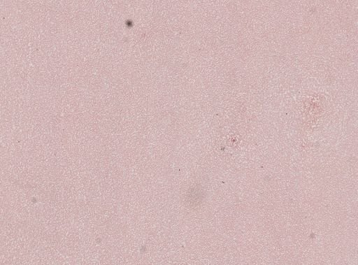 Plasmodium