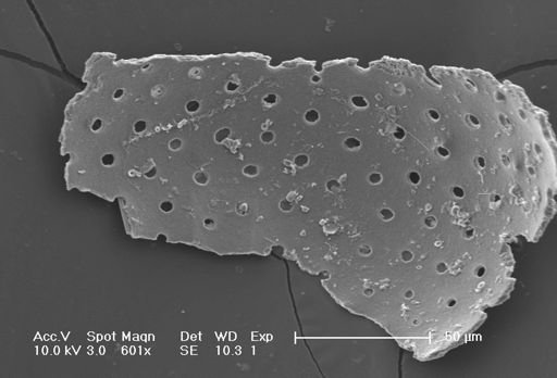 Globigerinoides sacculifer