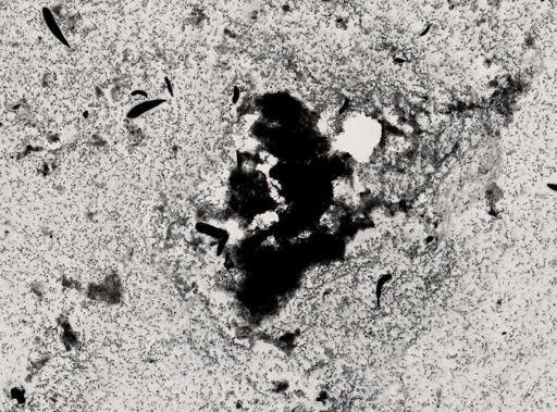Trichomonas augusta