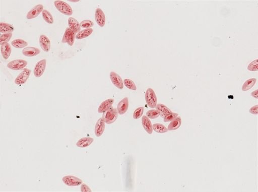 Paramecium calkinsi