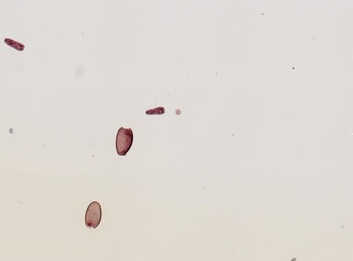 Fasciola hepatica