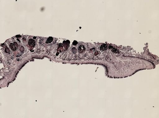 Pleioplana atomata