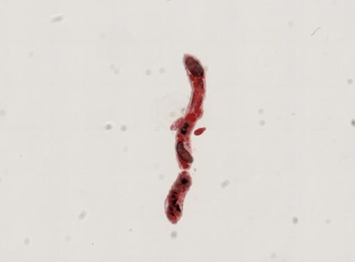 Trematoda