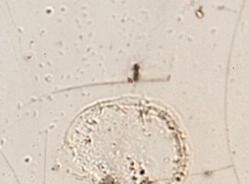 Paramecium