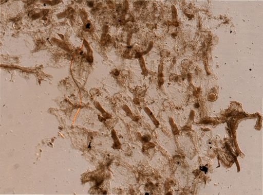 Bryozoa