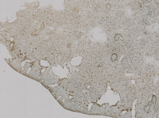 Pseudoceratina purpurea
