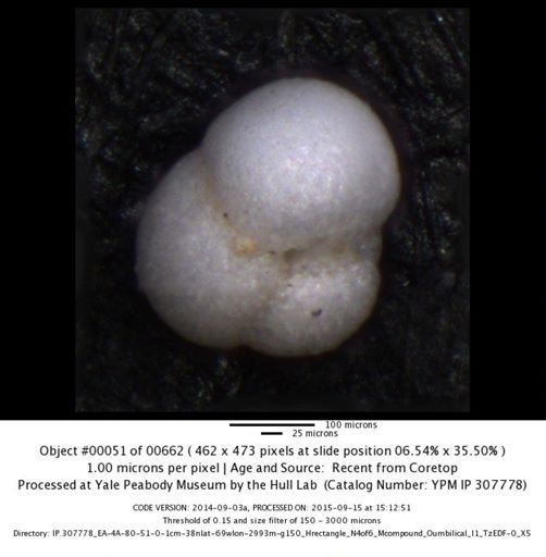 Globorotalia inflata