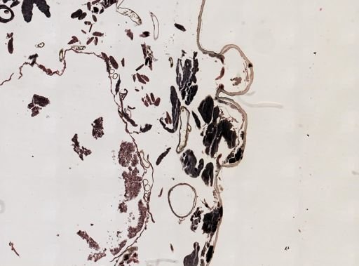 Nosema bombycis