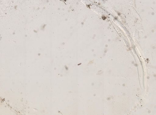 Paramecium