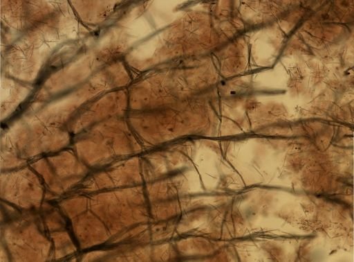 Isodictya deichmannae