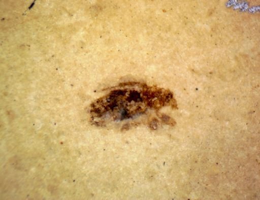 undet. Coleoptera