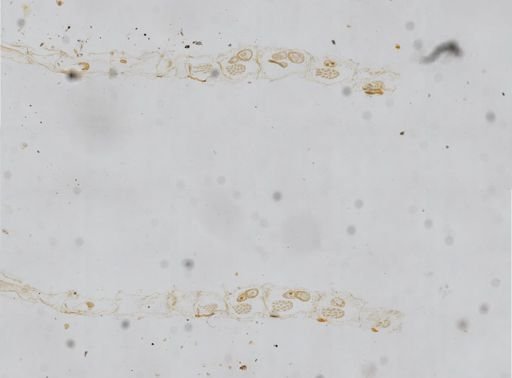 Schizoporella unicornis