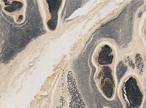 Pleistophora macrozoarcides