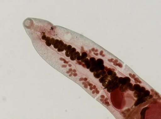 Haematoloechus medioplexus