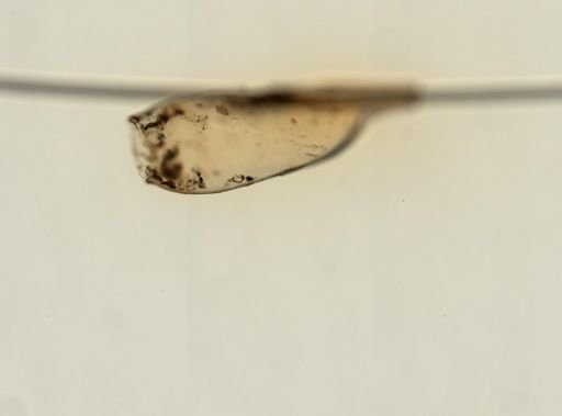 Pediculus humanus