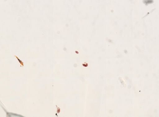Trematoda
