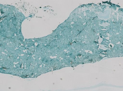 Halichondria