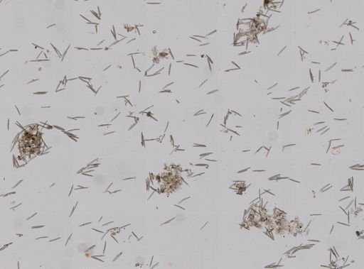 Haliclona oculata