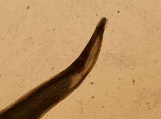 Enterobius vermicularis