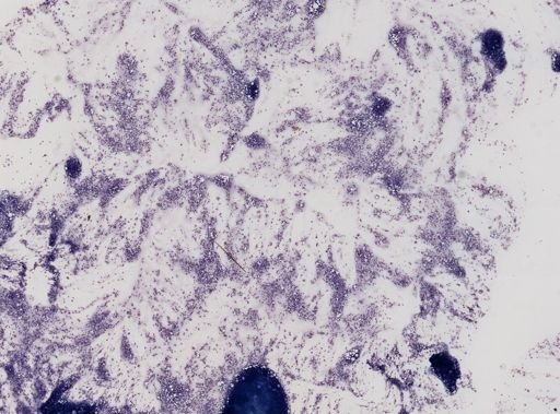 Plasmodium circumflexum