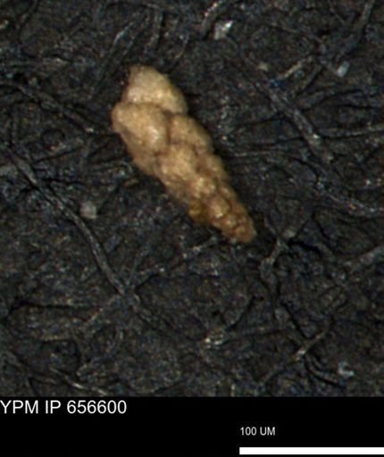 Verneuilina canadensis