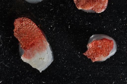 Bryozoa
