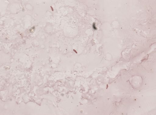 Paramecium aurelia