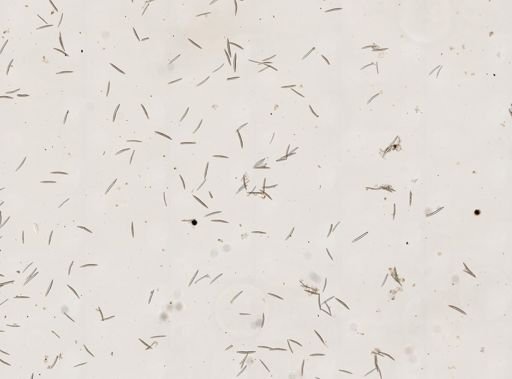 Haliclona oculata