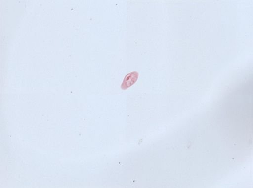 Paramecium aurelia
