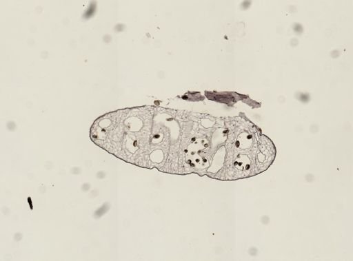 Dicrocoelium dendriticum
